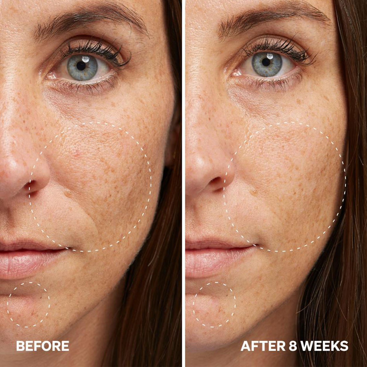 Aurawhispers✨ Last Day Buy 1 Get 1 Free💧 Brightening Serum-Helps improve dull skin texture and leaves appearance brighter.