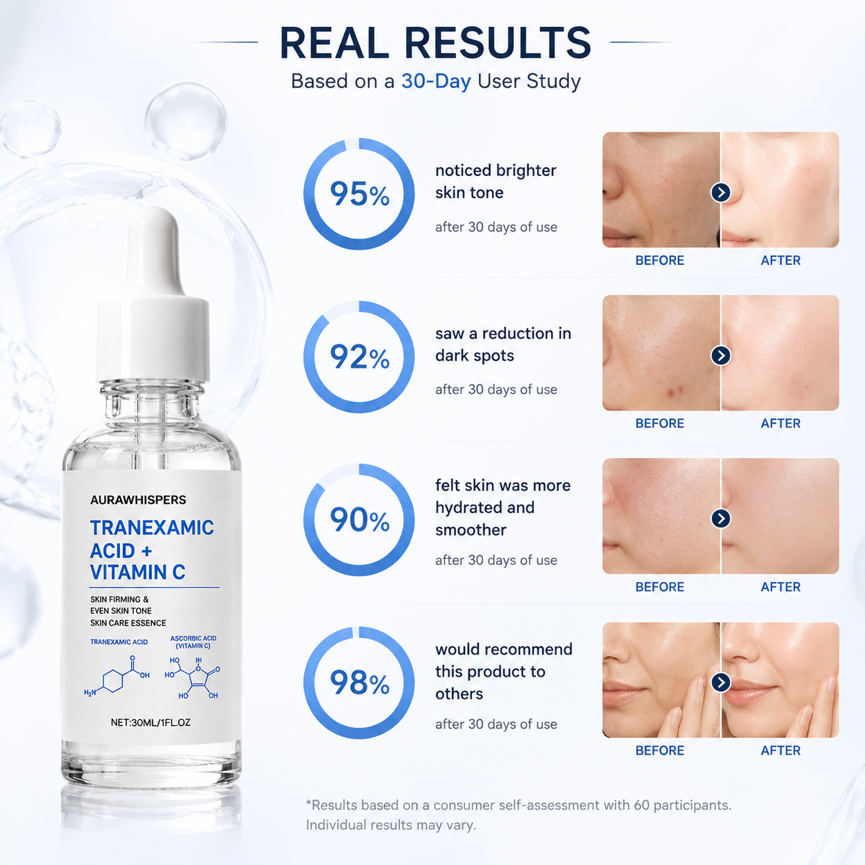 Aurawhispers✨ Last Day Buy 1 Get 1 Free💧 Brightening Serum-Helps improve dull skin texture and leaves appearance brighter.