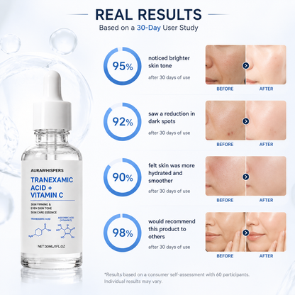 Aurawhispers✨ Last Day Buy 1 Get 1 Free💧 Brightening Serum-Helps improve dull skin texture and leaves appearance brighter.