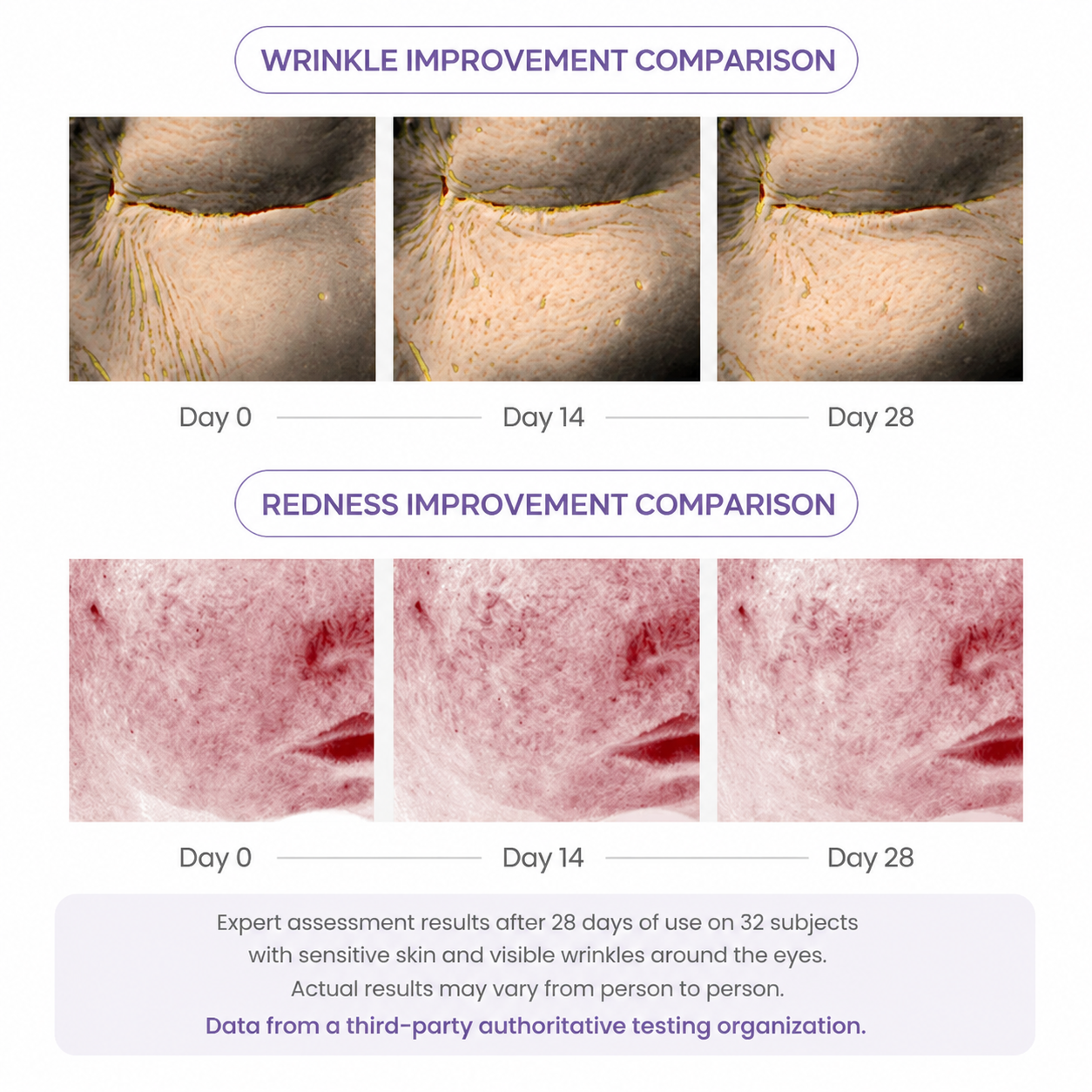 Joyivora 🌟Last Day Buy 1 Get 1 Free PDRN Wrinkle-Lift Tightening Cream
