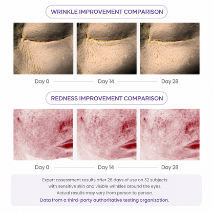 Joyivora 🌟Last Day Buy 1 Get 1 Free PDRN Wrinkle-Lift Tightening Cream