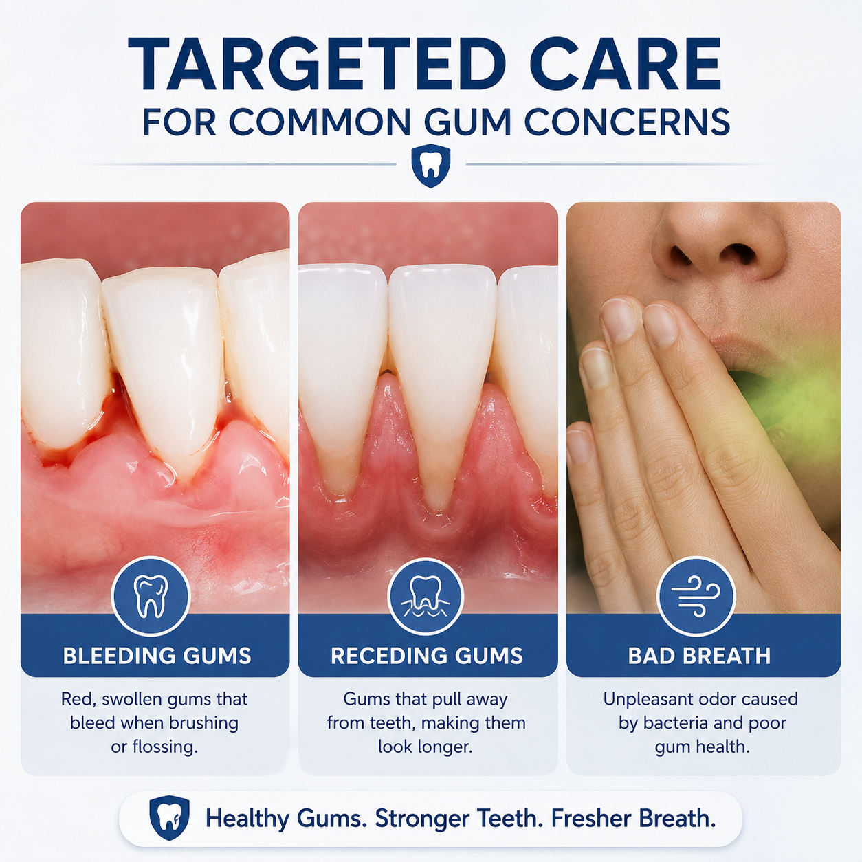 LOVILDS ✨Last Day Buy 1 Get 1 Free 🦷Advanced Gum & Teeth Care Gel