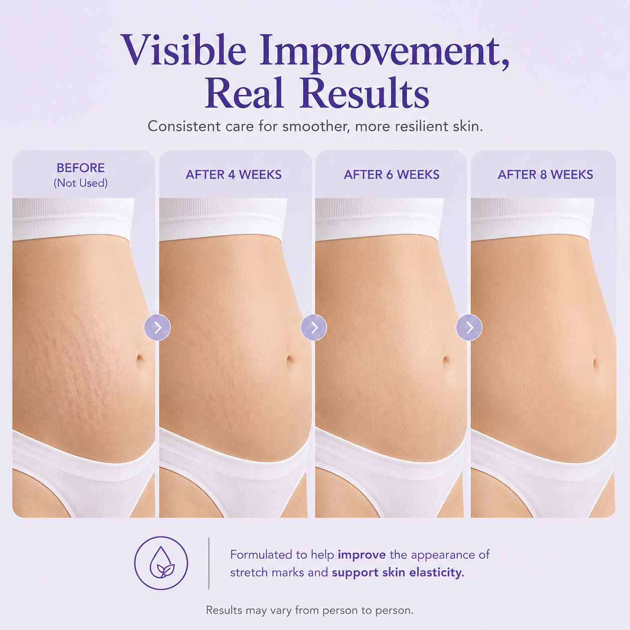 Mirevyn✨Last Day Buy 1 Get 1 Free✨Tighten & Smooth Belly Firming Cream