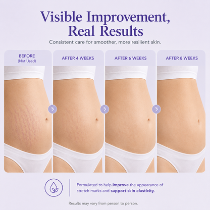 Mirevyn✨Last Day Buy 1 Get 1 Free✨Tighten & Smooth Belly Firming Cream