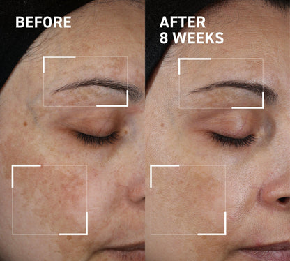 Aurawhispers✨ Last Day Buy 1 Get 1 Free💧 Brightening Serum-Helps improve dull skin texture and leaves appearance brighter.