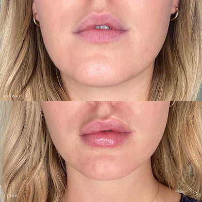 NESLEMY ✨ Last Day Buy 1 Get 1 Free 👄Hydrating Collagen Mouth Tape