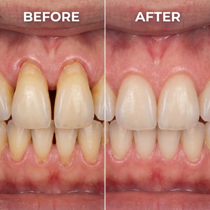 LOVILDS ✨Last Day Buy 1 Get 1 Free 🦷Advanced Gum & Teeth Care Gel